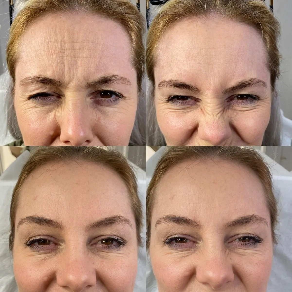 Before and after · results vary