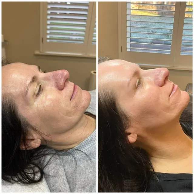 Advanced Skin at Pro Level Beauty