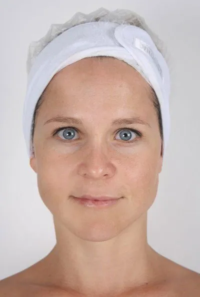 Nimue client 2, after treatment